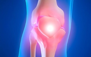 príčiny artrózy kolenného kĺbu