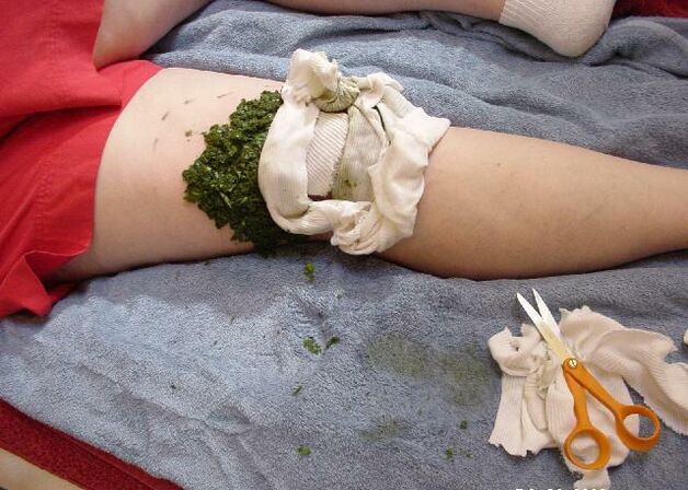 Teplý obklad z rozdrvených kapustných listov na boľavý kolenný kĺb s artrózou