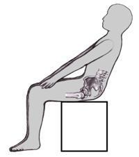 bolesti chrbta kostrč u žien